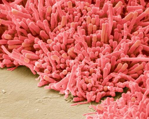 Plaque forming bacteria
